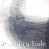 Immagini Radiologiche Andrea Scala