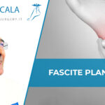 Fascite plantare con Dott. Scala
