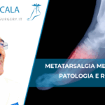 Metatarsalgia Meccanica