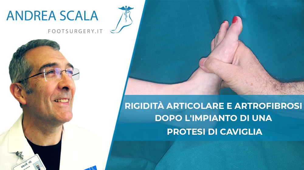 rigidità articolare protesi caviglia
