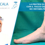 copertina-taglio-perone dott. Scala con caviglia in primo piano