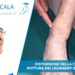 Distorsione della caviglia - Dott. Andrea Scala