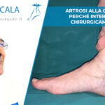 artrosi caviglia