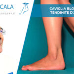 Caviglia bloccata e tendinite d’Achille
