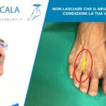 Non lasciare che il neuroma di Morton condizioni la tua vita: curalo.