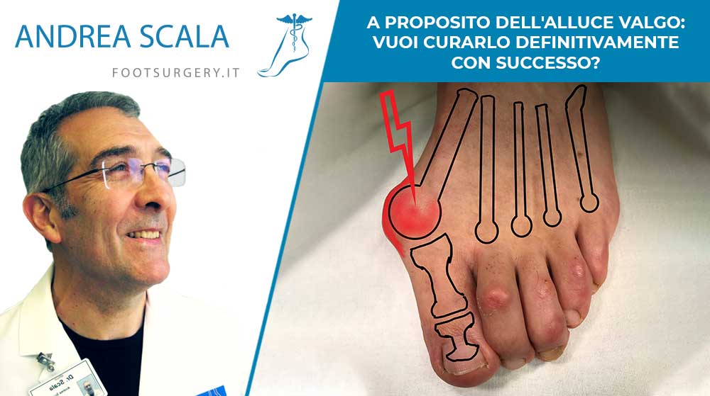 A proposito dell’alluce valgo: vuoi curarlo definitivamente con successo?