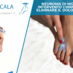 Neuroma di Morton: un intervento chirurgico per eliminare il dolore cronico