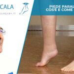 Piede paralitico: cos'è e come si cura