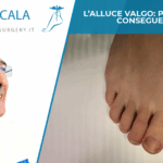 alluce valgo