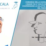 CHIRURGIA DELLA CAVIGLIA E DEL PIEDE. L’ESAME TAC E’ MOLTO IMPORTANTE PER COMPRENDERE LE MALATTIE E DELLA CAVIGLIA E DEL PIEDE.