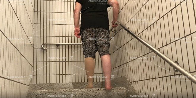 Posizione della paziente sul gradino della scala. Appoggiata al corrimano in tutta sicurezza. Appoggia solo la parte anteriore del piede.