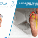 Il Neuroma di Morton