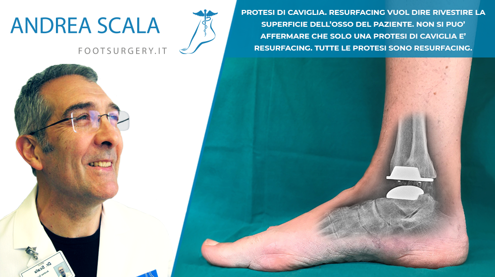 PROTESI DI CAVIGLIA RESURFACING