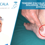 Tendine d'Achille infiammato soluzioni terapeutiche efficaci
